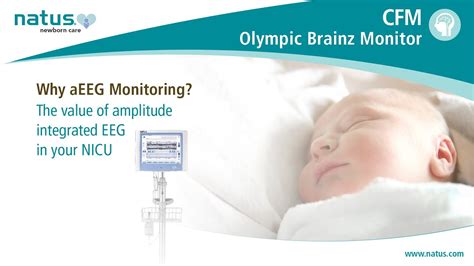 Why Aeeg Monitoring The Cfm Olympic Braniz Monitor In Your Nicu Youtube