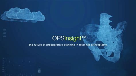 Opsinsight Preoperative Planning For Total Hip Arthroplasty Youtube