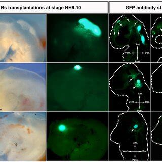 In Vitro Migration Of IPSC Derived Wild Type And Mutant Cranial Neural