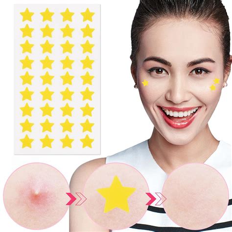 Mini Star Butterfly Invisible Acne Removal Pimple Patch Pimple Acne