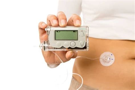 Máy Bơm Insulin Tự động Tiện Và Không Tiện Merinco