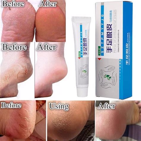 Buy Skin Care Repair Anti Dry Crack Cream Hand Foot Crack Cream Heel