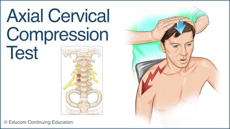 Axial Cervical Compression Test A Chiropractic Online CE Production