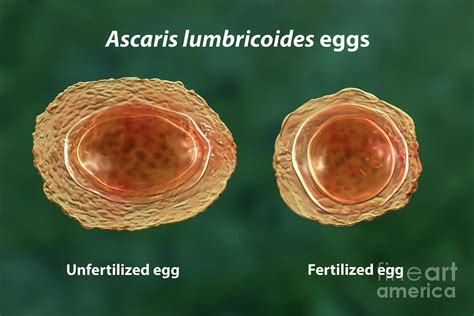 Eggs Of The Parasite Ascaris Lumbricoides Photograph By Kateryna Konscience Photo Library Pixels