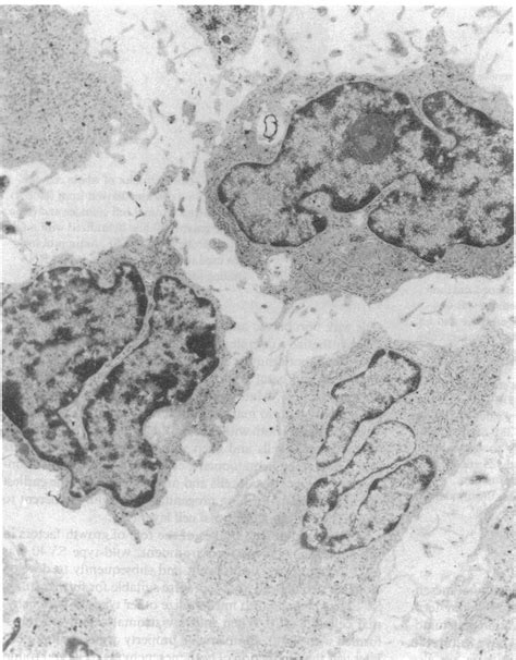 Electron Microscopic View X Of A Colony Derived Stromal Cell