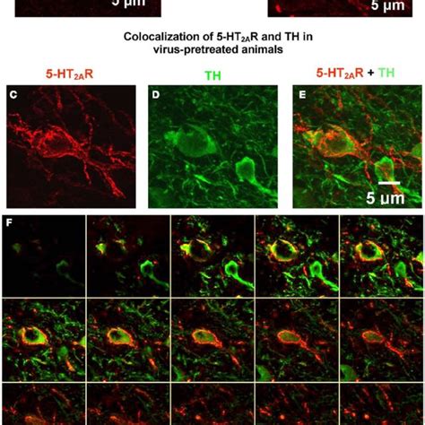 Confocal Microscopy Demonstrates Robust 5 Ht 2a R Labeling In The Vta