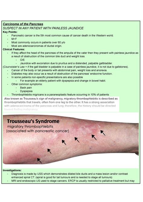 Trousseaus Sign Of Malignancy