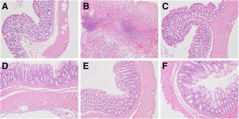 Histological Features Of Colon Segments Stained With Hematoxylin And Download Scientific