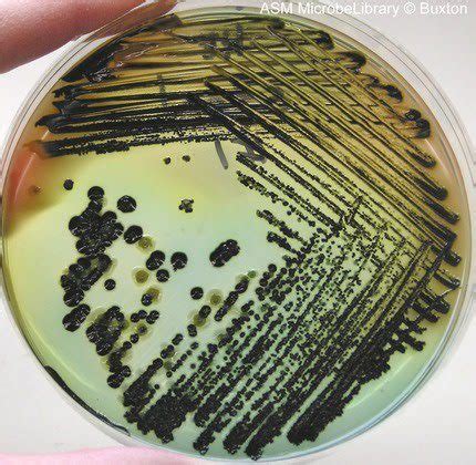 Hektoen Enteric Agar Scheda Del Terreno Di Coltura Per Microbiologia