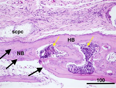 Photomicrographs Showing Decalcified Histological Sections Of Group