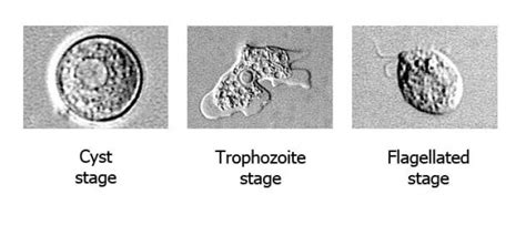 Korea Reports 1st Case Of Brain Eating Amoeba Infection The Korea Times