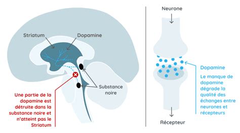 Tout Savoir Sur La Maladie De Parkinson Définitions Origines Symptômes Diagnostic Et