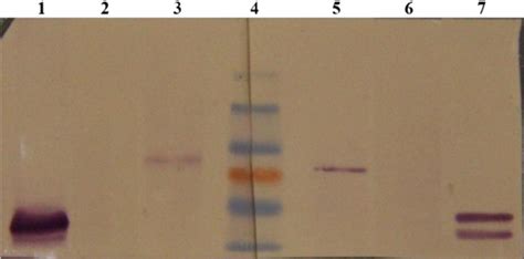 Hpv L Protein Expression Detection In Hela Cells By Western Blotting