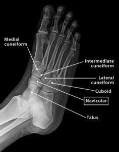 Navicular Bone - Location, Anatomy, & Labeled Diagram