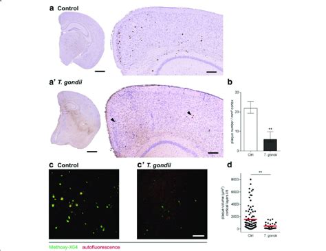 T Gondii Infection Leads To Reduced Plaque Burden In 5xFAD Mice A A