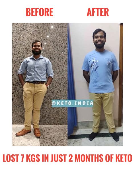 Keto Diet Success Transformation Of Vinesh Keto India Testimonials