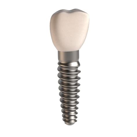 3d Dental Implant