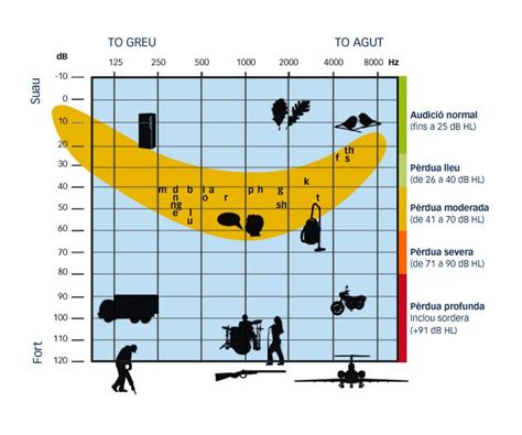 Graus de pèrdua auditiva Audiopacks Audiologia i logopèdia a