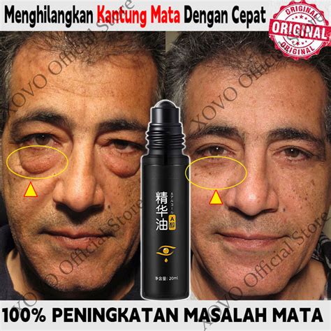 Jual Serum Mata Cream 20ml Menghilangkan Kantung Mata Dengan Cepat Krim