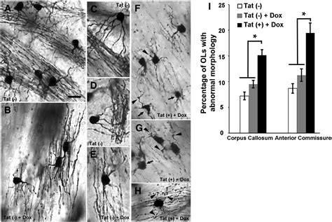 Oligodendrocytes Are Targets Of HIV 1 Tat NMDA And AMPA Receptor