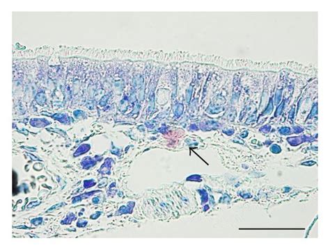 Micrographs Showing Toluidine Blue Stained Sections Of Nasal Septum