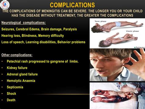 Ppt What Is Meningitis Powerpoint Presentation Free Download Id5047399