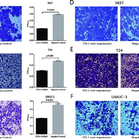 Ets Promoted Bladder Cancer Cell Migration In Vitro A T B