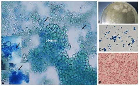 Transformation of L-forms into classical bacteria ((A) arrows) in broth ...