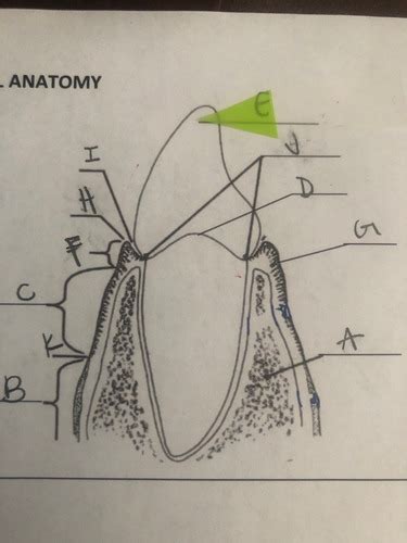 Gingival Anatomy Labeling Flashcards Quizlet