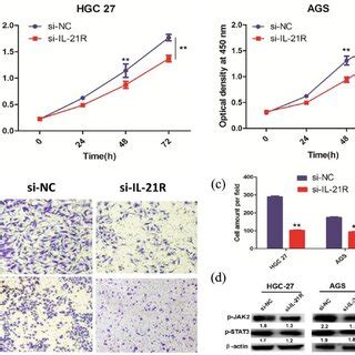 L 21R Knockdown Inhibits Cell Proliferation And Invasion Through