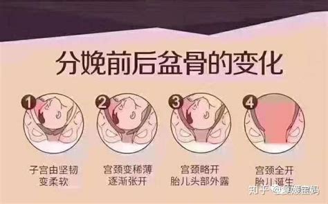 产后修复的顺序，你知道吗 知乎