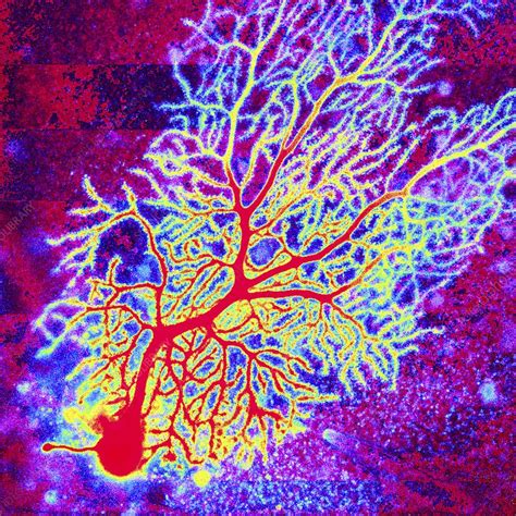 Purkinje Nerve Cell Confocal Micrograph Stock Image C