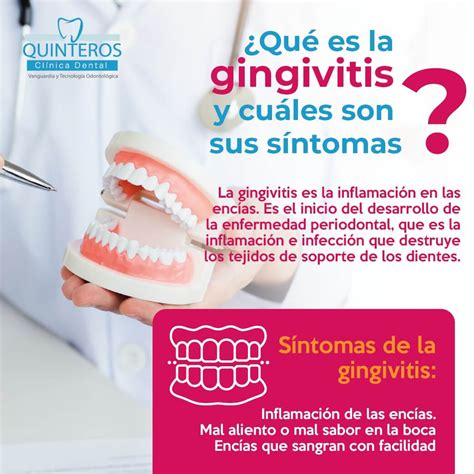 Beneficios Del Hilo Dental Y Como Usarlo Blog Dental Consejos Para