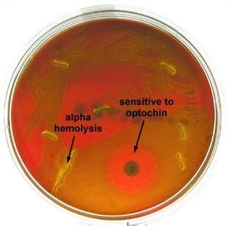 16: Streptococcus pneumoniae growing on Blood Agar | Download Scientific Diagram