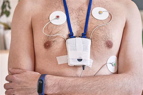 24 Hour Holter Monitoring — Hurstville Private Heart Centre · Cardiology · South Sydney