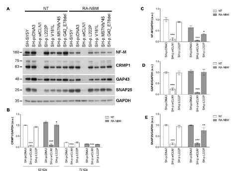 Figure 5 From The Networks Of Genes Encoding Palmitoylated Proteins In