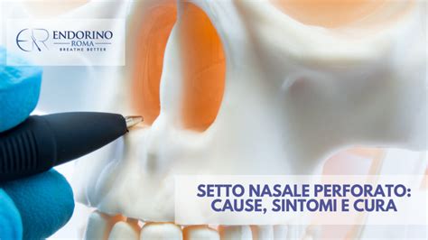 Setto Nasale Perforato Cause Sintomi E Cura OrtognaticaRoma