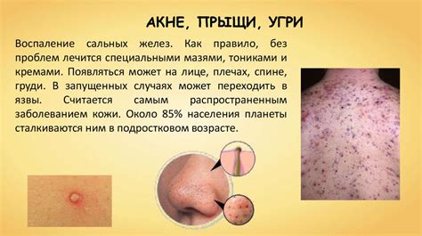 Болезни и травмы кожи - презентация онлайн