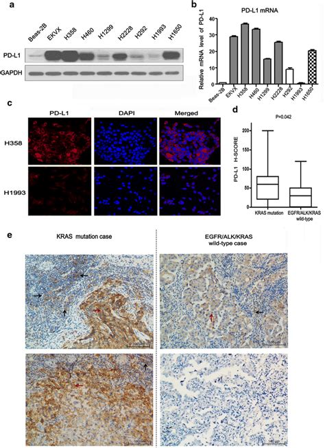 Pd L1 Expression Correlated With Kras Mutation A The Protein