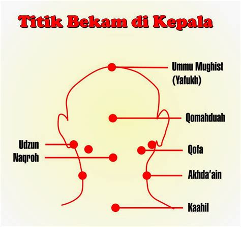 BEKAM TITIK SUNAH NABI Klinik Bekam Thibbun Nabawi ABU AULIA