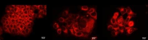 Detection Of Lipid Droplets Nile Red Staining In The Population Of