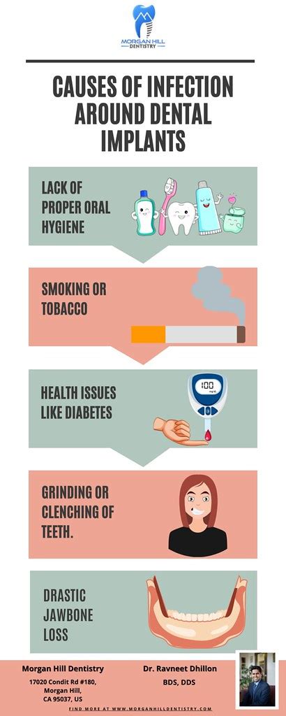 Causes Of Infection Around Dental Implants Dental Implants Flickr