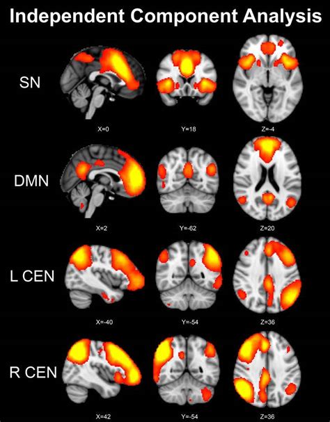 Identifying Key Nodes Of Intrinsic Connectivity Networks Icns Using