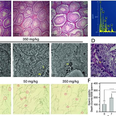 Effects Of Zno Nps On The Number And Morphology Of Tm4 Cell Nuclei A