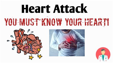 Heart Attack Myocardial Infarctionmi Ischemic Heart Diseasesyou