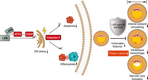 Protective Functions Of Liver X Receptor In Established Vulnerable