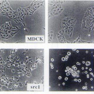 Histology Of V Src MDCK Cells Growing In Nude Mice Left Subcutaneous