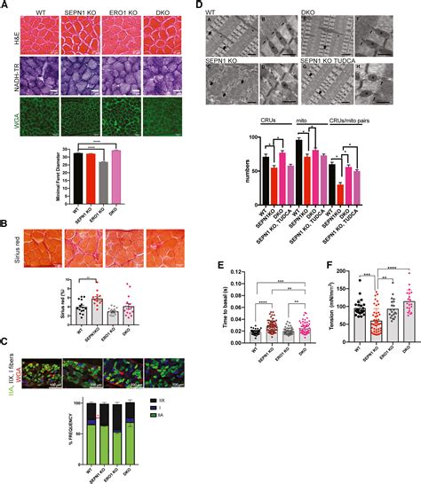 SEPN1 Related Myopathy Depends On The Oxidoreductase ERO1A And Is