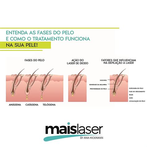 Depilação a laser conheça as fases do ciclo dos pelos Maislaser