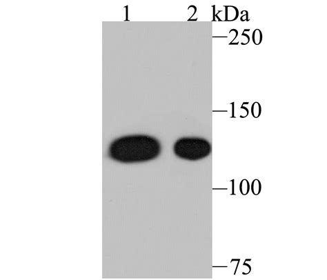 Nesprin 1 Rabbit MAb SAB Signalway Antibody